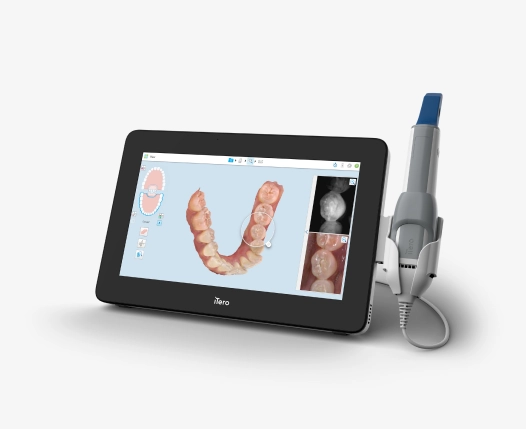 iTero Element 5D Plus intraoral scanner